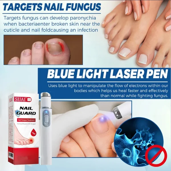 Nail Fungus Laser Device Fungal Nail Treatment Repair Onychomycosis Toenail Fingernail Removes Pedicure Foot Care Fungi Ingrown - Image 4