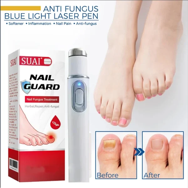 Nail Fungus Laser Device Fungal Nail Treatment Repair Onychomycosis Toenail Fingernail Removes Pedicure Foot Care Fungi Ingrown - Image 3