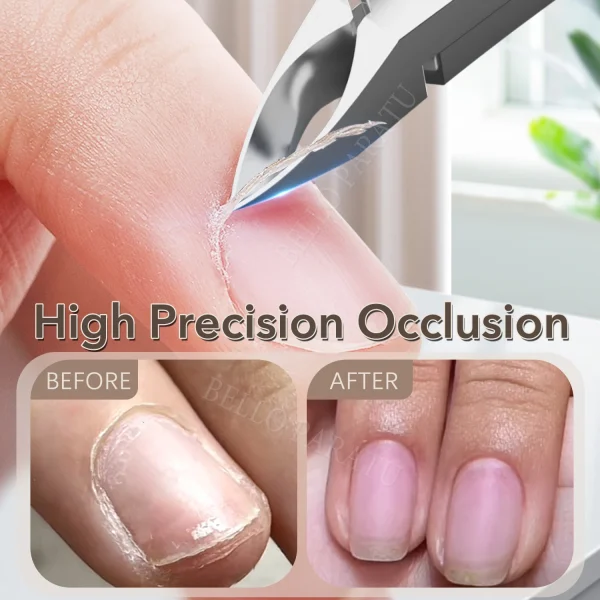 1Pcs Cuticle Trimmer Professional Cuticle Nippers Stainless Steel Clippers Cutter Remover Manicure Nail Tools for Women - Image 3