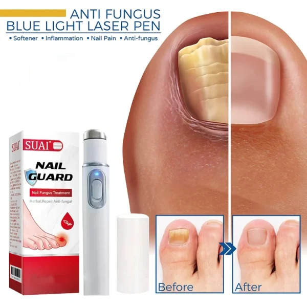Nail Fungus Laser Device Fungal Nail Treatment Repair Onychomycosis Toenail Fingernail Removes Pedicure Foot Care Fungi Ingrown - Image 5