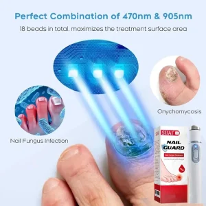 Nail Fungus Laser Device Fungal Nail Treatment Repair Onychomycosis Toenail Fingernail Removes Pedicure Foot Care Fungi Ingrown